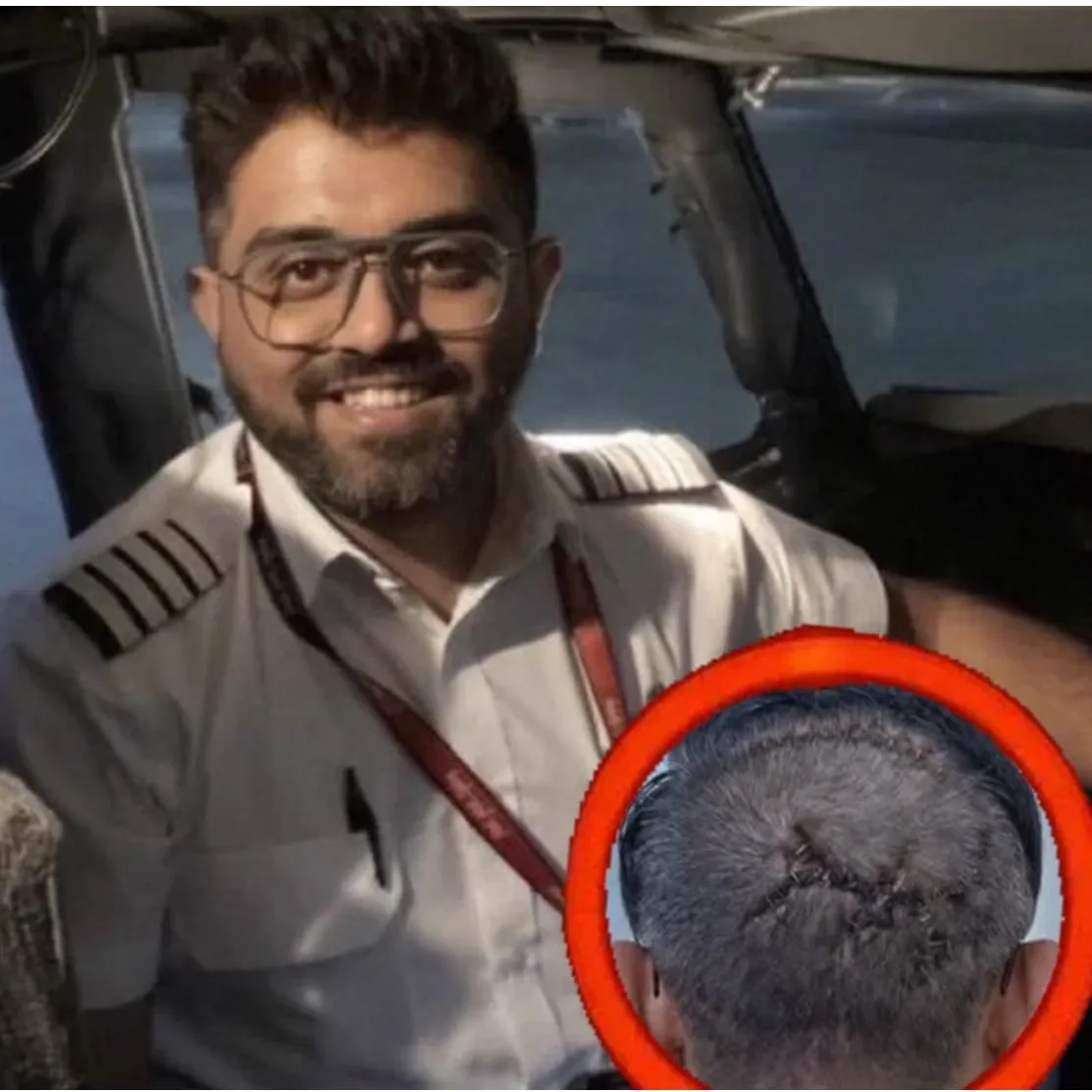 कैप्टन स्मित मच्छार के सिर पर चोट के निशान चर्चा में, UAE ने किया सम्मानित